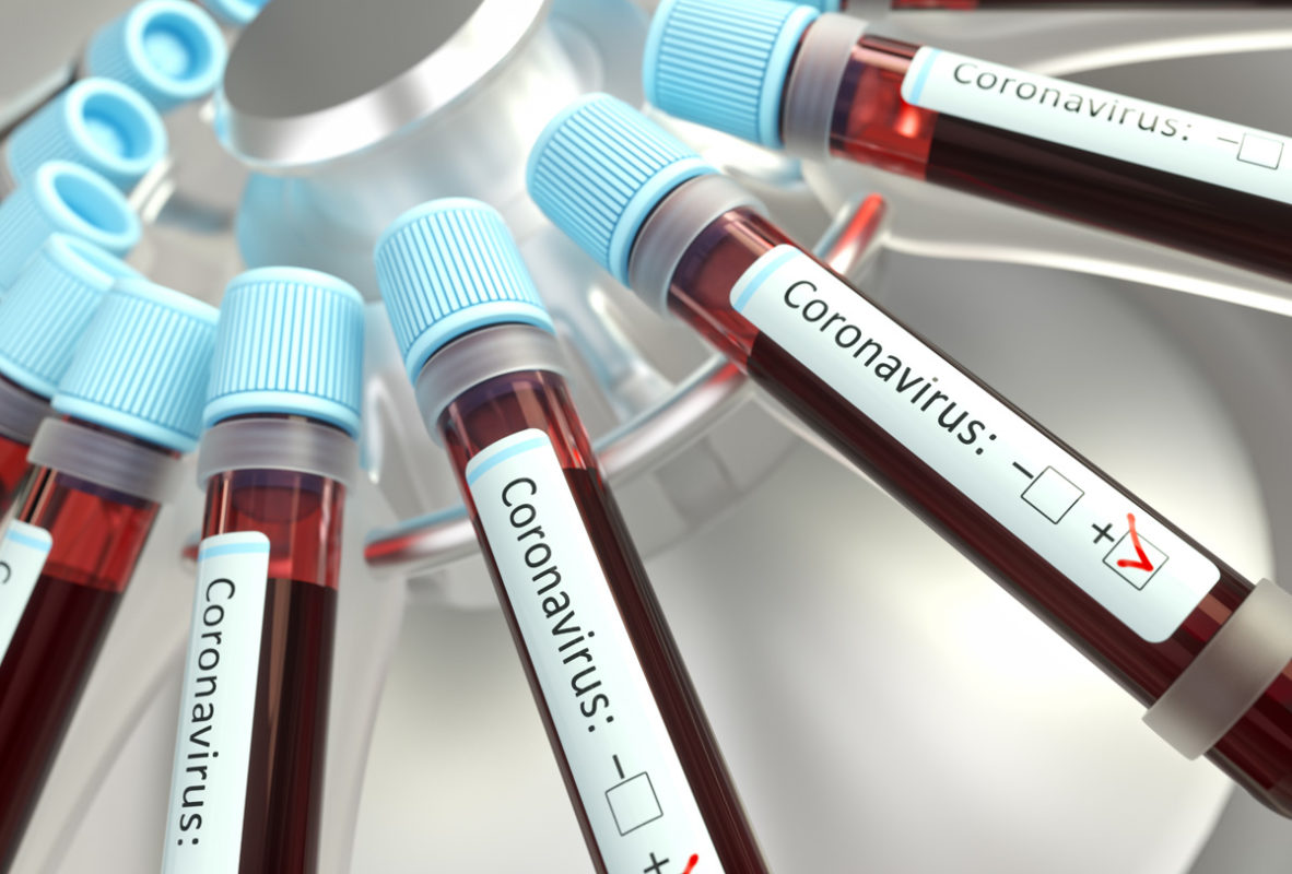 ¿Qué hago si sospecho que tengo coronavirus COVID19? Coronavirus México